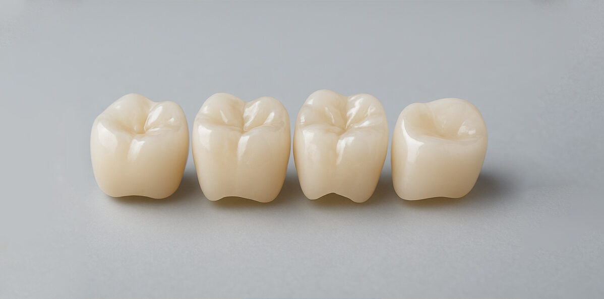Can Dental Crowns Fix Cosmetic Issues? A Look at Aesthetic Benefits